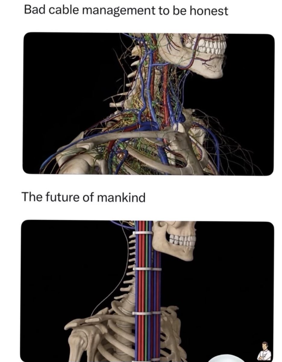 A meme featuring two images of a human skeleton: the top image shows tangled, disorganized cables and blood vessels around the neck, labeled "Bad cable management to be honest," and the bottom image shows the same skeleton with neatly bundled, color-coded cables running down the spine, labeled "The future of mankind."
